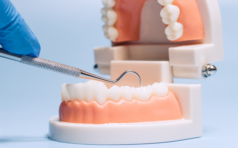 Dụng cụ lấy vôi răng là thiết bị được sử dụng trong nha khoa để loại bỏ mảng bám và vôi răng.