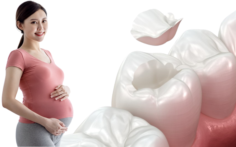 Trám răng cho mẹ bầu cần thực hiện đúng thời điểm, sử dụng vật liệu phù hợp theo chỉ định của bác sĩ nha khoa 
