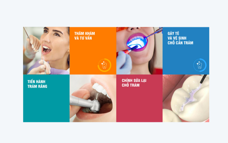 Quy trình trám răng bằng vật liệu GIC