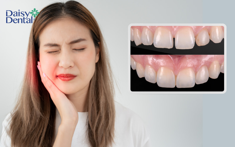 Hiểu rõ những nguyên nhân giúp bạn trao đổi hiệu quả hơn với bác sĩ nha khoa để tìm ra giải pháp tốt nhất cho tình trạng trám răng xong bị ê buốt.