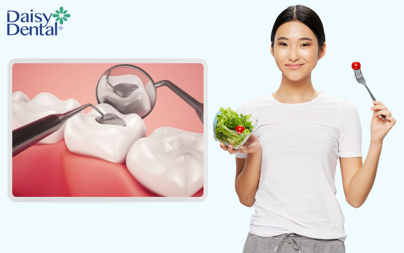 Bạn hoàn toàn có thể ăn sau khi trám răng, tuy nhiên thời gian bạn có thể ăn lại phụ thuộc vào loại vật liệu trám mà bạn đã sử dụng.