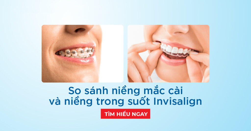 3. Chế Độ Bảo Hành